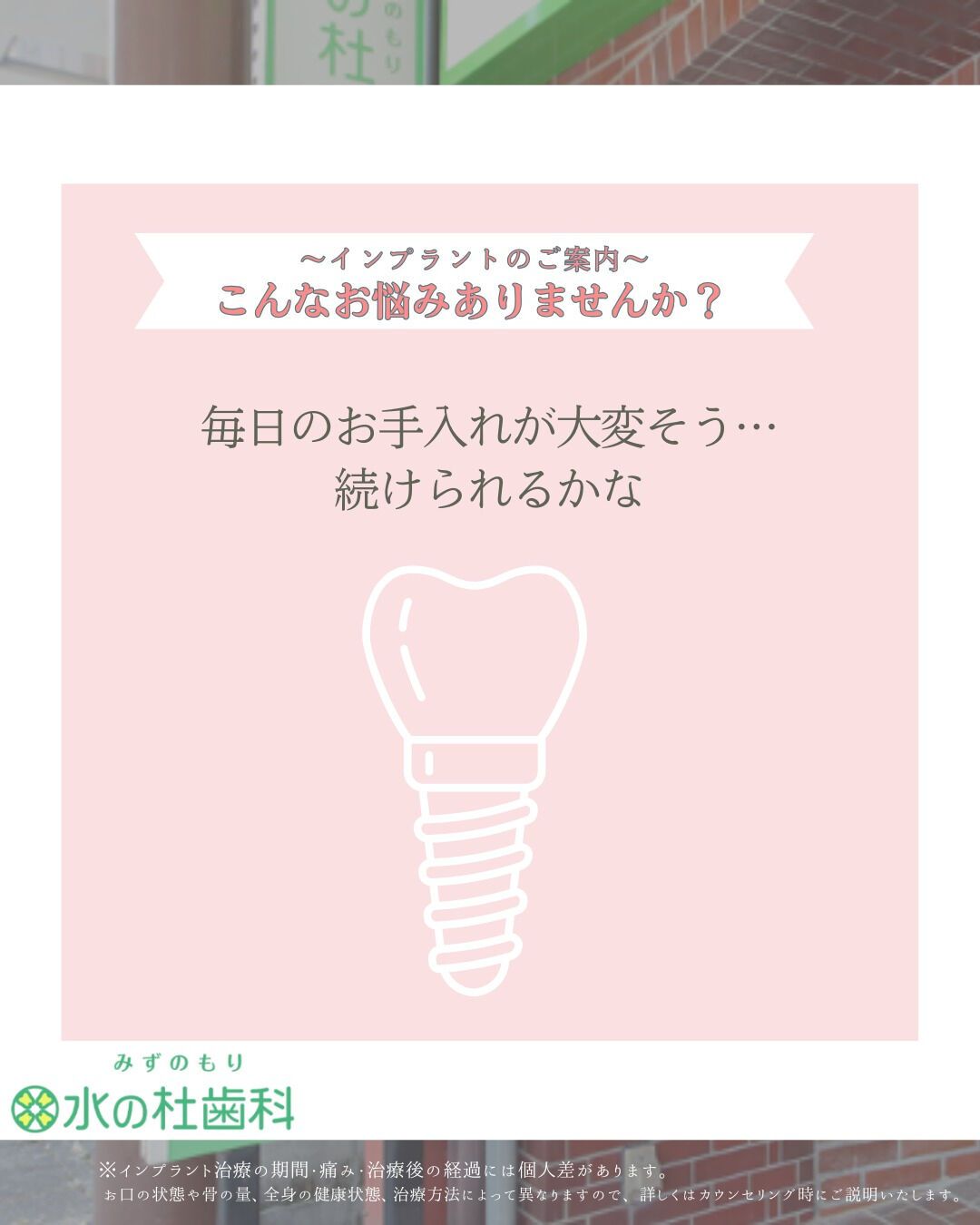 インプラントについてこんな不安はありませんか？🦷